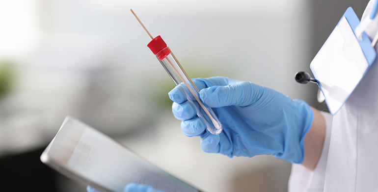 ¿Qué es PCR y cómo funcionan?