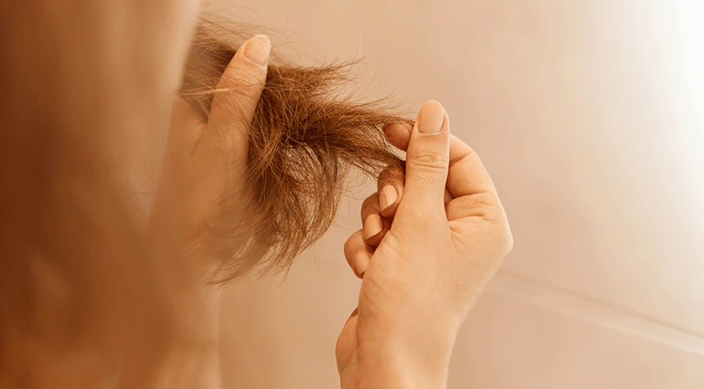 Prevenir la caída del cabello